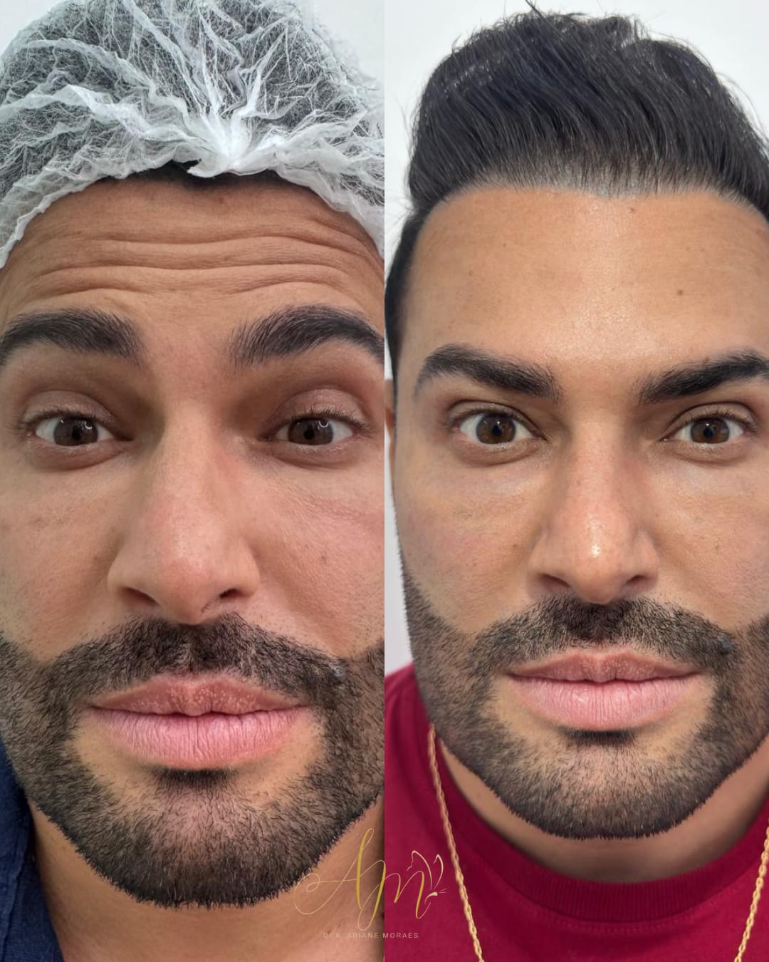 Evolução visível