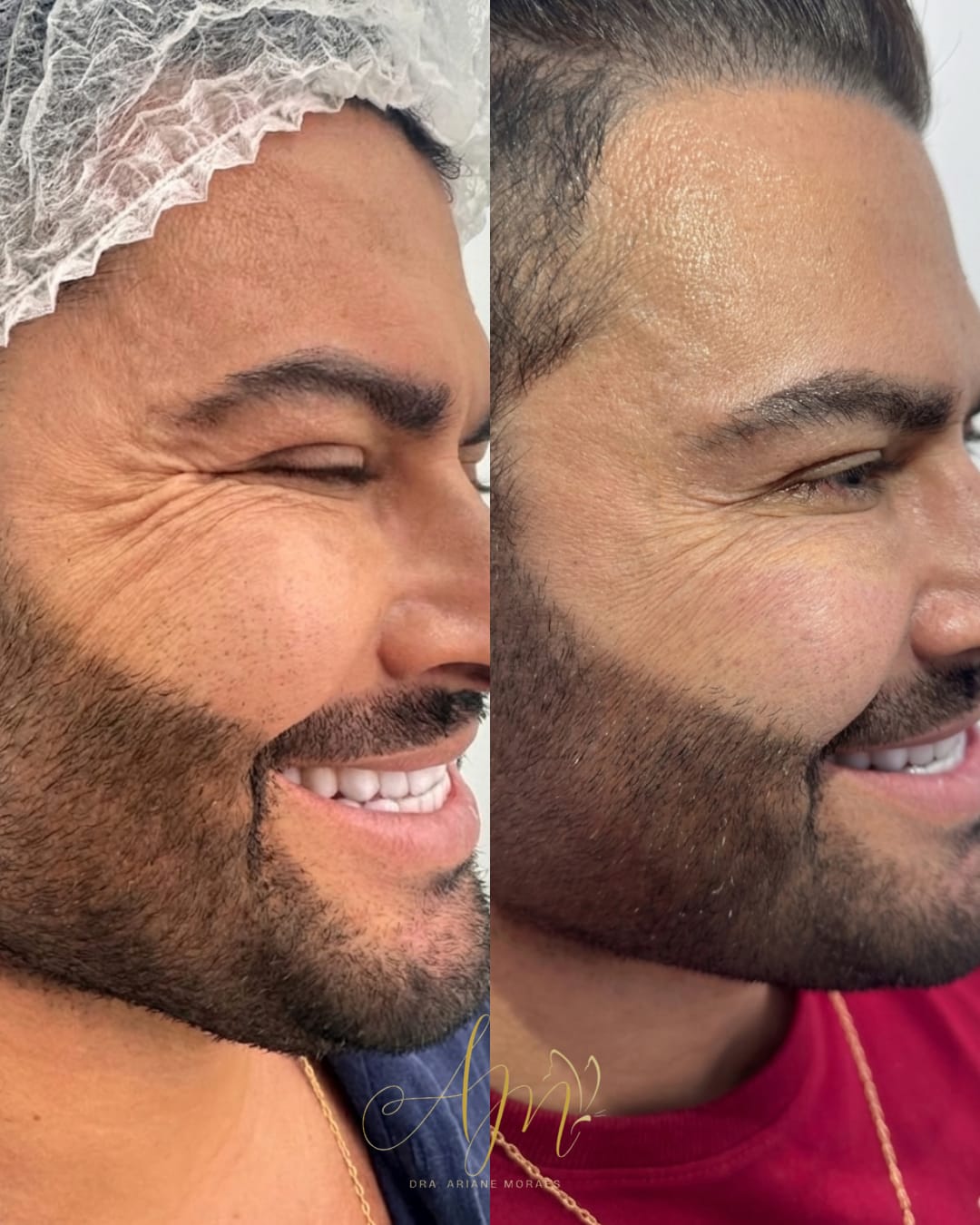 Harmonia e acabamento