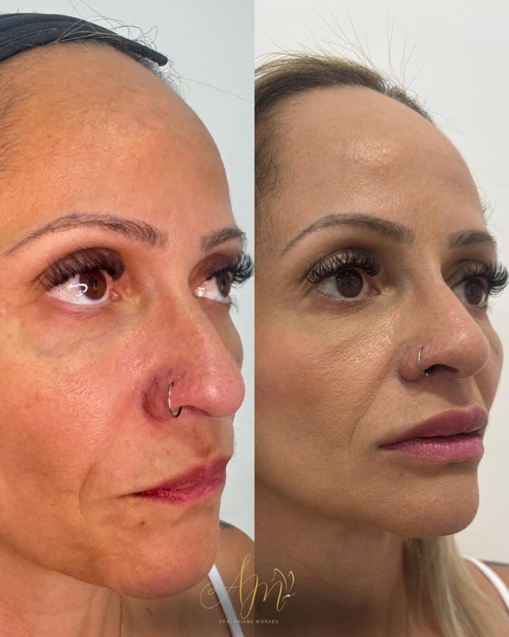 Resultado comparativo